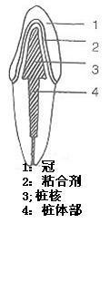 植牙需要多长时间，要花多少钱。