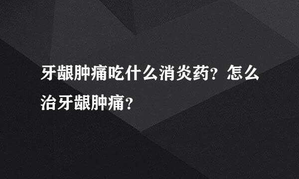 牙龈肿痛吃什么消炎药？怎么治牙龈肿痛？