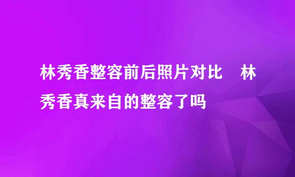 林秀香整容前后照片对比 林秀香真来自的整容了吗