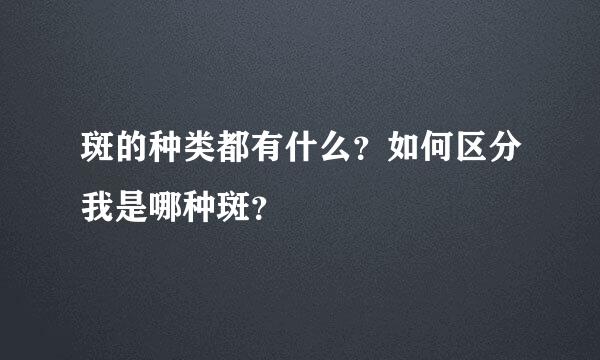 斑的种类都有什么？如何区分我是哪种斑？