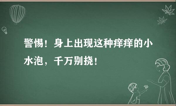 警惕！身上出现这种痒痒的小水泡，千万别挠！