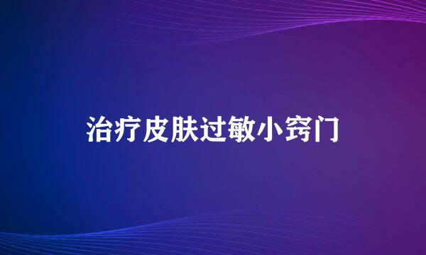治疗皮肤过敏小窍门