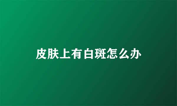 皮肤上有白斑怎么办