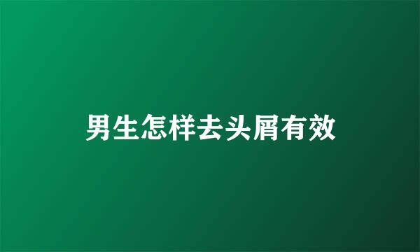 男生怎样去头屑有效