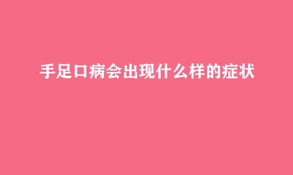 手足口病会出现什么样的症状