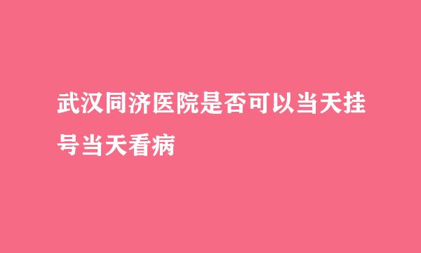 武汉同济医院是否可以当天挂号当天看病