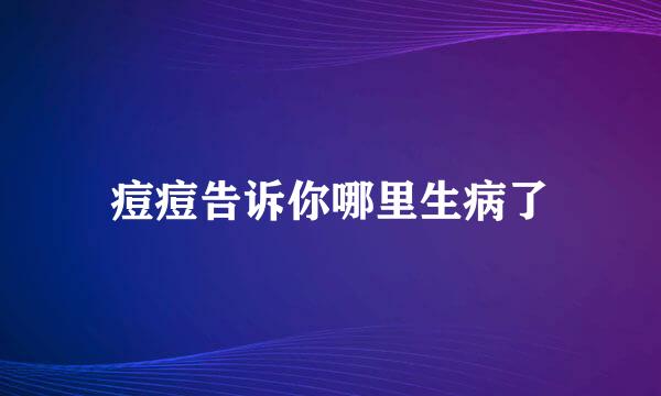痘痘告诉你哪里生病了